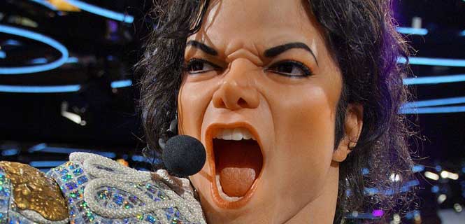 Michael Jackson vitiligo